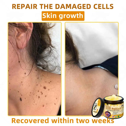QIAWI™ 🐝Bee Poison Skin Restoration Cream 🐝（🔥LAST DAY SALE-80% OFF)🥇👩‍⚕️