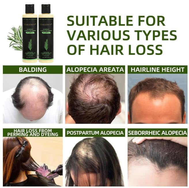 TAILEDEN® Rosemary Hydrolyzed Keratin Shampoo – Gentle Daily Scalp Care for Dry, Sensitive Scalp
