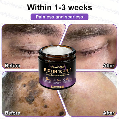Made and Shipped from USA ✨Evolvion® Biotin 10-in-1 Skin Restoration Cream 🚀 🚀