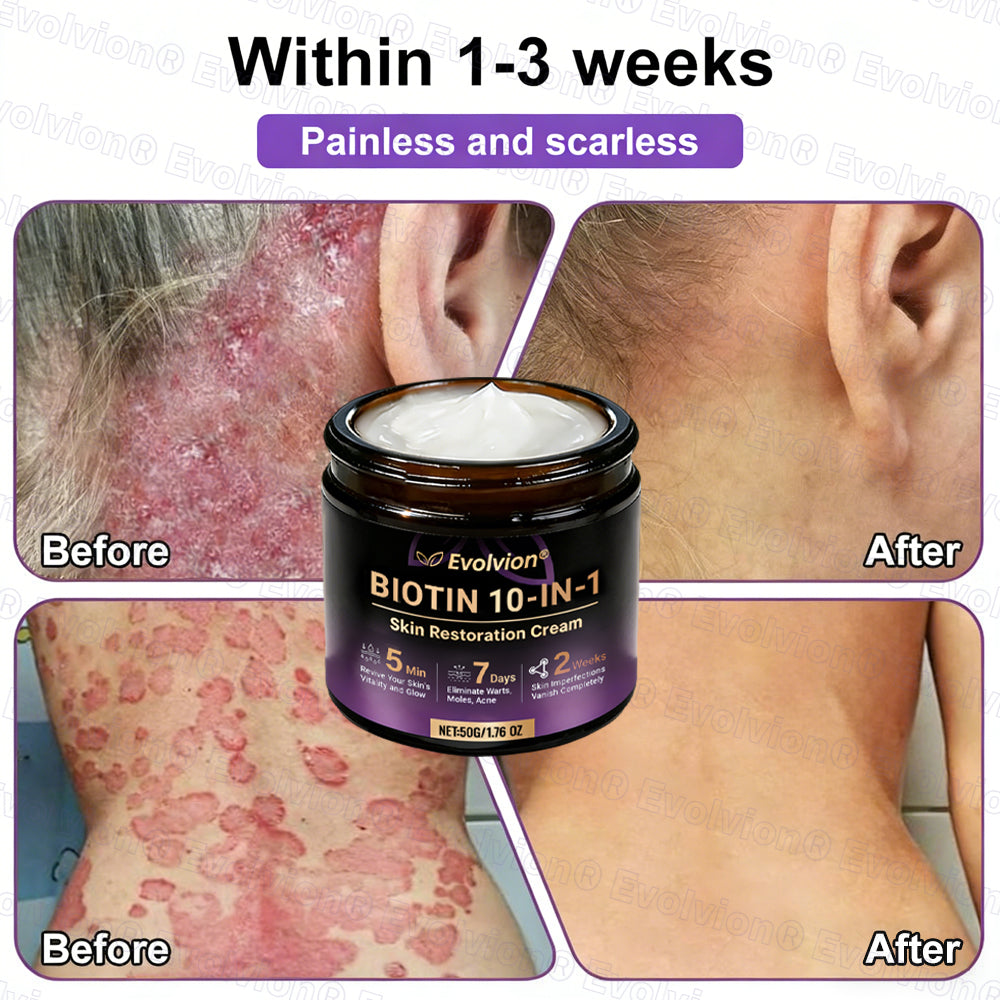 Made and Shipped from USA ✨Evolvion® Biotin 10-in-1 Skin Restoration Cream 🚀 🚀