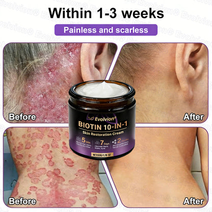 Made and Shipped from USA ✨Evolvion® Biotin 10-in-1 Skin Restoration Cream 🚀 🚀