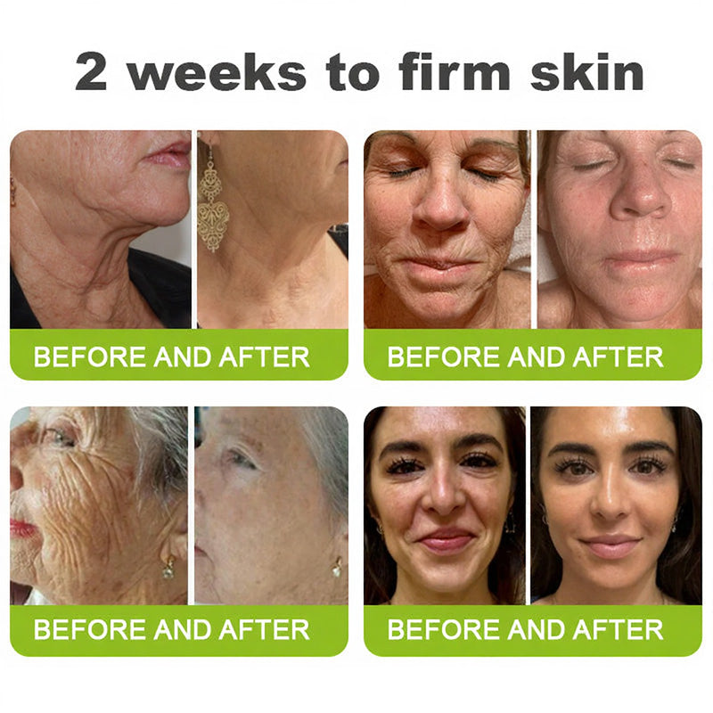 🧠👨‍⚕️Made and shipped from the USA 💫Lovilds® Botin & Vita-A Retinol Shot Wrinkle-Lift Tightening cream - Last Day Promotion 50% OFF