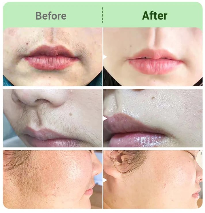 TAILEDEN™ Hair Removal Cream for All Women & Men