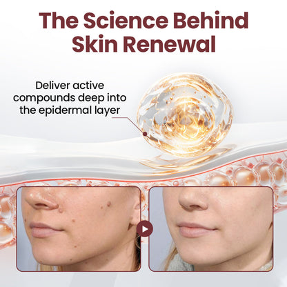 NATRAVOR®KeraErase Dual-Action Renewal Cream