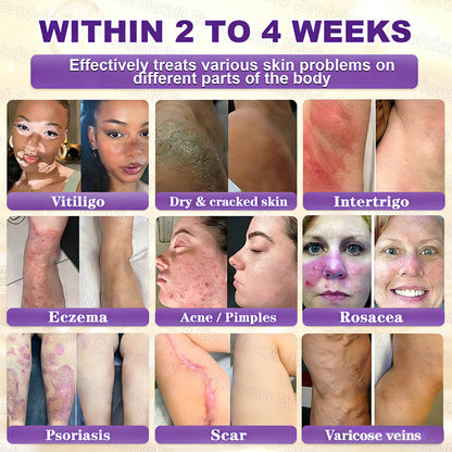 Made and Shipped from USA ✨Evolvion® Biotin 10-in-1 Skin Restoration Cream 🚀 🚀