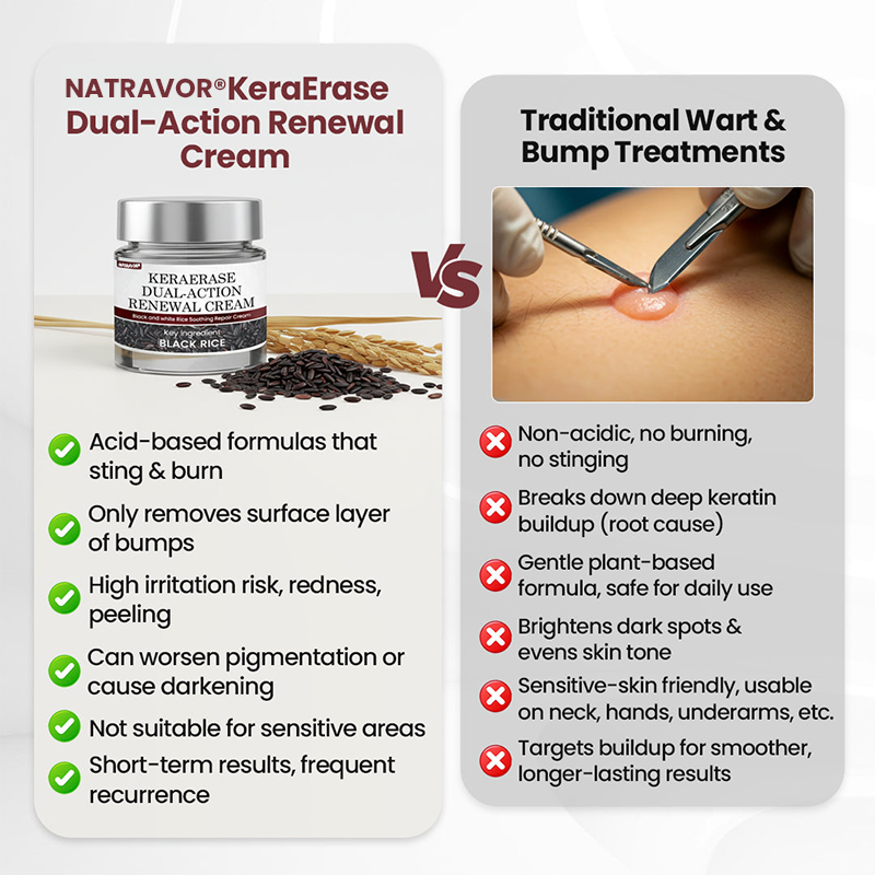 NATRAVOR®KeraErase Dual-Action Renewal Cream