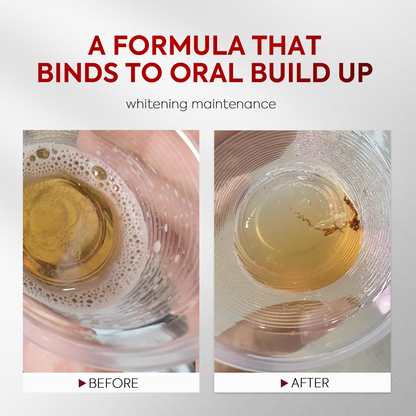 Advanced Stain-Lifting Whitening Mouthwash: Visible Debris Removal & Fresh Breath