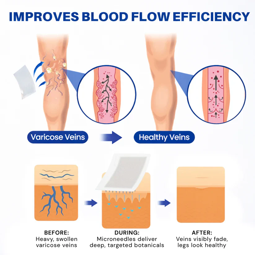 Cougex® 𝑽𝗲𝗶𝙣 𝘾𝐨𝐧𝘁𝗼𝙪𝙧 𝙈𝙞𝐜𝐫𝒐𝒏𝒆𝗲𝗱𝗹𝙚 𝙋𝙖𝐭𝐜𝒉 𝒘𝒊𝘁𝗵 𝗔𝙙𝙫𝙖𝙣𝙘𝐞𝐝 𝐃𝒊𝒐𝒔𝗺𝙞𝐧 & 𝑯𝒆𝘀𝗽𝗲𝙧𝙞𝙙𝙞𝐧 𝐃𝒆𝒍𝒊𝒗𝗲𝗿𝙮🌿𝟕-𝐃𝐚𝐲 𝐕𝐢𝐬𝐢𝐛𝐥𝐞 𝐑𝐞𝐬𝐮𝐥𝐭𝐬 𝐟𝐨𝐫 𝐕𝐚𝐫𝐢𝐜𝐨𝐬𝐞 𝐕𝐞𝐢𝐧𝐬