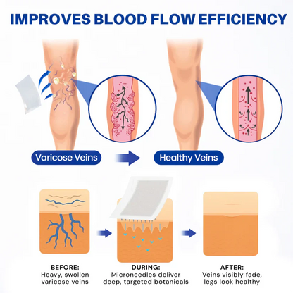 Cougex® 𝑽𝗲𝗶𝙣 𝘾𝐨𝐧𝘁𝗼𝙪𝙧 𝙈𝙞𝐜𝐫𝒐𝒏𝒆𝗲𝗱𝗹𝙚 𝙋𝙖𝐭𝐜𝒉 𝒘𝒊𝘁𝗵 𝗔𝙙𝙫𝙖𝙣𝙘𝐞𝐝 𝐃𝒊𝒐𝒔𝗺𝙞𝐧 & 𝑯𝒆𝘀𝗽𝗲𝙧𝙞𝙙𝙞𝐧 𝐃𝒆𝒍𝒊𝒗𝗲𝗿𝙮🌿𝟕-𝐃𝐚𝐲 𝐕𝐢𝐬𝐢𝐛𝐥𝐞 𝐑𝐞𝐬𝐮𝐥𝐭𝐬 𝐟𝐨𝐫 𝐕𝐚𝐫𝐢𝐜𝐨𝐬𝐞 𝐕𝐞𝐢𝐧𝐬