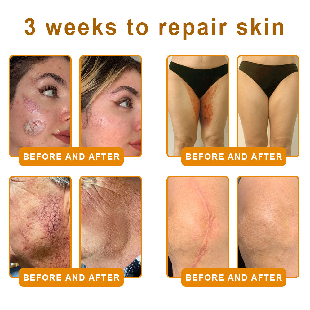 QIAWI™ 🐝Bee Poison Skin Restoration Cream 🐝（🔥LAST DAY SALE-80% OFF)🥇👩‍⚕️