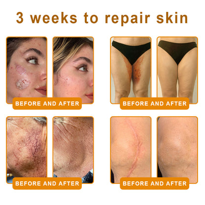 QIAWI™ 🐝Bee Poison Skin Restoration Cream 🐝（🔥LAST DAY SALE-80% OFF)🥇👩‍⚕️