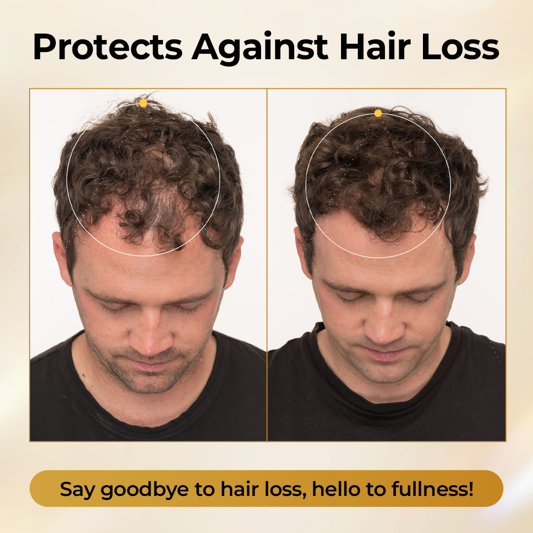 Diystar® CollagenGrow Peptides Hair Growth Spray