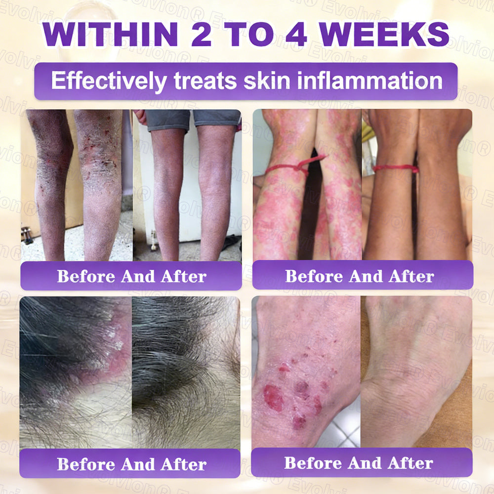 Made and Shipped from USA ✨Evolvion® Biotin 10-in-1 Skin Restoration Cream 🚀 🚀