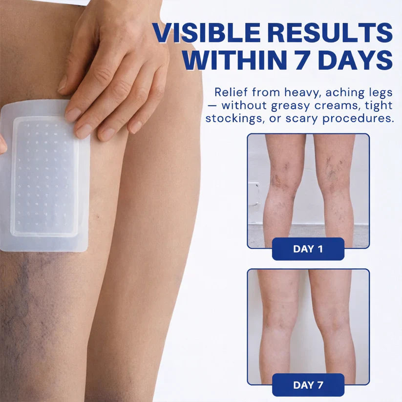 Cougex® 𝑽𝗲𝗶𝙣 𝘾𝐨𝐧𝘁𝗼𝙪𝙧 𝙈𝙞𝐜𝐫𝒐𝒏𝒆𝗲𝗱𝗹𝙚 𝙋𝙖𝐭𝐜𝒉 𝒘𝒊𝘁𝗵 𝗔𝙙𝙫𝙖𝙣𝙘𝐞𝐝 𝐃𝒊𝒐𝒔𝗺𝙞𝐧 & 𝑯𝒆𝘀𝗽𝗲𝙧𝙞𝙙𝙞𝐧 𝐃𝒆𝒍𝒊𝒗𝗲𝗿𝙮🌿𝟕-𝐃𝐚𝐲 𝐕𝐢𝐬𝐢𝐛𝐥𝐞 𝐑𝐞𝐬𝐮𝐥𝐭𝐬 𝐟𝐨𝐫 𝐕𝐚𝐫𝐢𝐜𝐨𝐬𝐞 𝐕𝐞𝐢𝐧𝐬