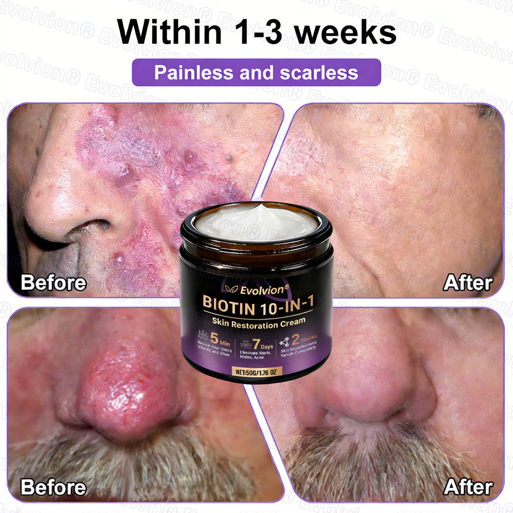 Made and Shipped from USA ✨Evolvion® Biotin 10-in-1 Skin Restoration Cream 🚀 🚀