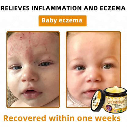 QIAWI™ 🐝Bee Poison Skin Restoration Cream 🐝（🔥LAST DAY SALE-80% OFF)🥇👩‍⚕️