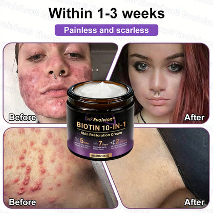 Made and Shipped from USA ✨Evolvion® Biotin 10-in-1 Skin Restoration Cream 🚀 🚀