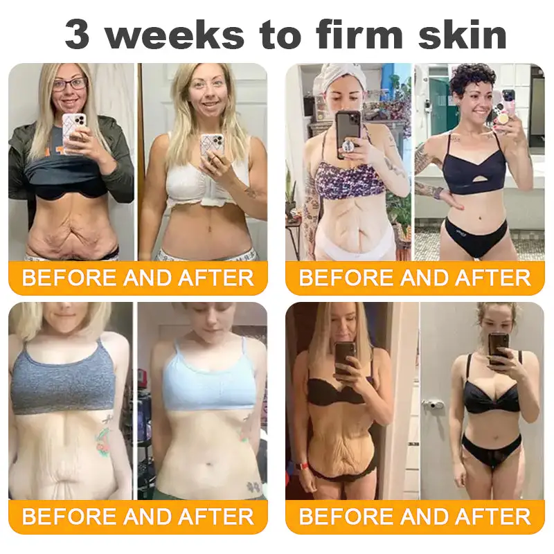 QIAWI™ 🐝Bee Poison Skin Restoration Cream 🐝（🔥LAST DAY SALE-80% OFF)🥇👩‍⚕️