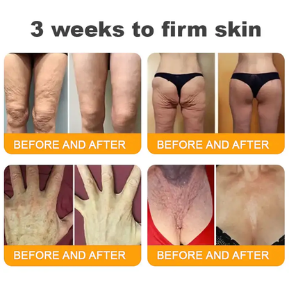 QIAWI™ 🐝Bee Poison Skin Restoration Cream 🐝（🔥LAST DAY SALE-80% OFF)🥇👩‍⚕️