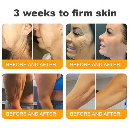 QIAWI™ 🐝Bee Poison Skin Restoration Cream 🐝（🔥LAST DAY SALE-80% OFF)🥇👩‍⚕️