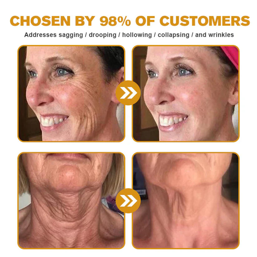 QIAWI™ 🐝Bee Poison Skin Restoration Cream 🐝（🔥LAST DAY SALE-80% OFF)🥇👩‍⚕️