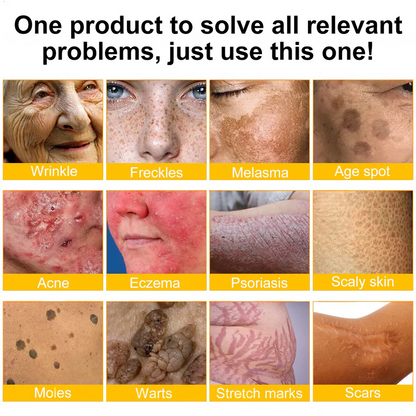QIAWI™ 🐝Bee Poison Skin Restoration Cream 🐝（🔥LAST DAY SALE-80% OFF)🥇👩‍⚕️