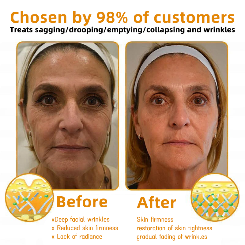 QIAWI™ 🐝Bee Poison Skin Restoration Cream 🐝（🔥LAST DAY SALE-80% OFF)🥇👩‍⚕️