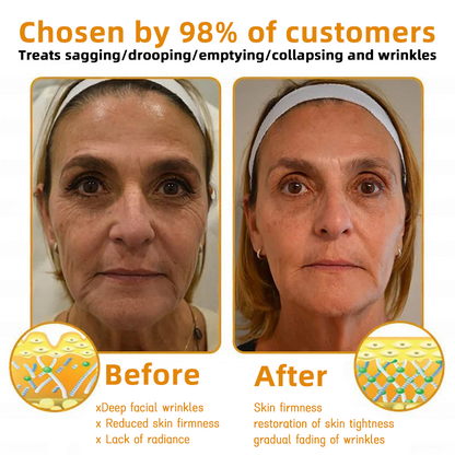 QIAWI™ 🐝Bee Poison Skin Restoration Cream 🐝（🔥LAST DAY SALE-80% OFF)🥇👩‍⚕️