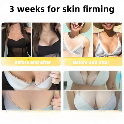 QIAWI™ 🐝Bee Poison Skin Restoration Cream 🐝（🔥LAST DAY SALE-80% OFF)🥇👩‍⚕️