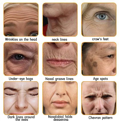 QIAWI™ 🐝Bee Poison Skin Restoration Cream 🐝（🔥LAST DAY SALE-80% OFF)🥇👩‍⚕️