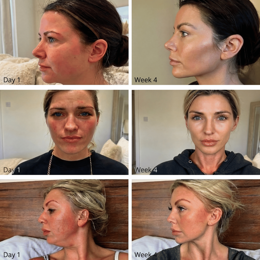 Lymphatic Drainage Wellness Drops