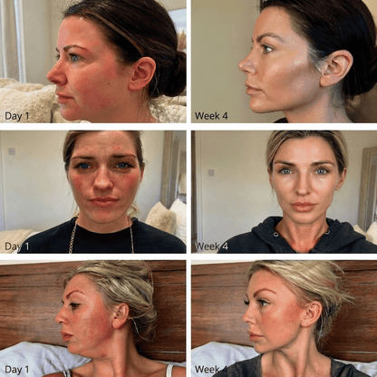 Lymphatic Drainage Wellness Drops