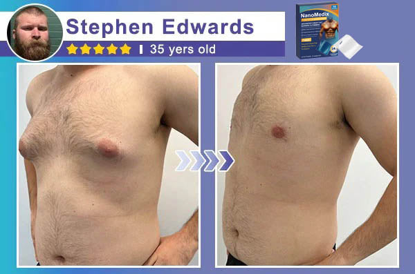 🏆20K+ SOLD LAST WEEK! 🌿CHEST FAT BURNING FIRMING PATCH (Set of 18)-8JX3