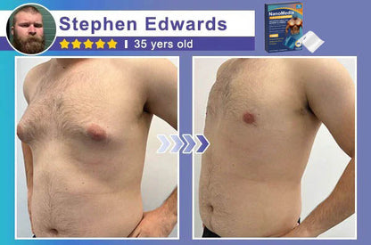 🏆20K+ SOLD LAST WEEK! 🌿CHEST FAT BURNING FIRMING PATCH (Set of 18)-8JX3