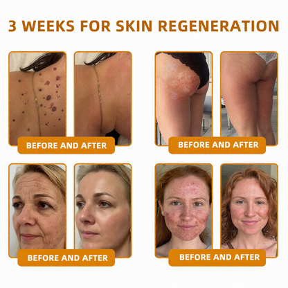 QIAWI™ 🐝Bee Poison Skin Restoration Cream 🐝（🔥LAST DAY SALE-80% OFF)🥇👩‍⚕️